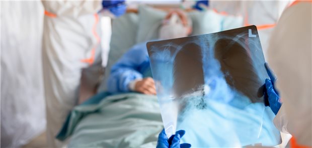 COVID-19 lässt die Erlöse großer Krankenhäuser purzeln In der Hochphase der Pandemie mussten viele Betten für Coronapatienten freigehalten werden.
