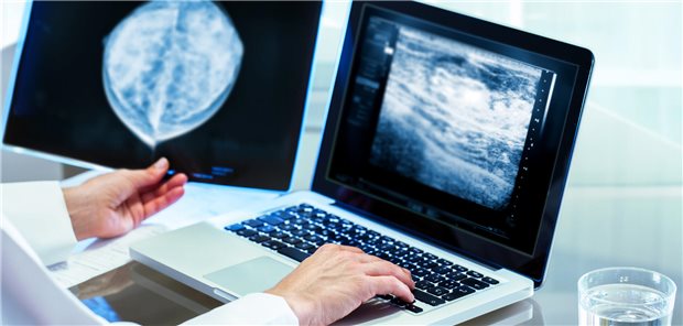 Nahaufnahme einer Ärztin, die die Mammographie-Ergebnisse auf einem Röntgenbild und einer Nahaufnahme des Röntgenbildes auf dem Laptopbildschirm bewertet.