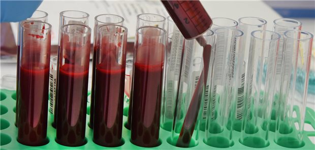Röhrchen im Labor mit Blut gefüllt