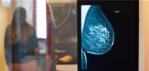 Ausgelassene Vorsorgen: AOK rechnet mit mehr schweren Krebsverläufen In der Pandemie haben weniger Frauen am Mammografie-Screening teilgenommen.