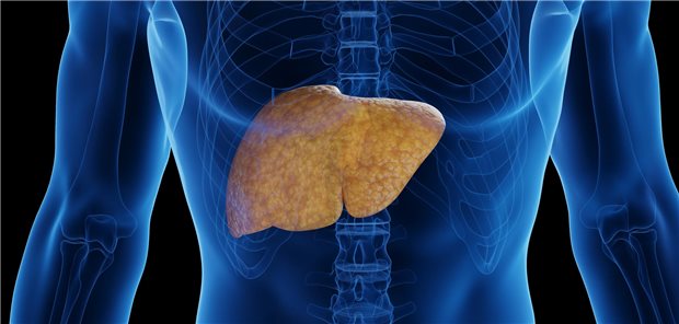 In der Studie MAESTRO-NASH gelang die NASH-Rückbildung bei 30 Prozent der Behandelten mit der hohen sowie 26 Prozent mit der niedrigeren Dosierung, aber nur knapp 10 Prozent mit Placebo. Eine Verbesserung der Fibrose erreichten 26 Prozent mit der hohen und 24 Prozent mit der niedrigeren Dosis, aber nur 14 Prozent unter Placebo. 