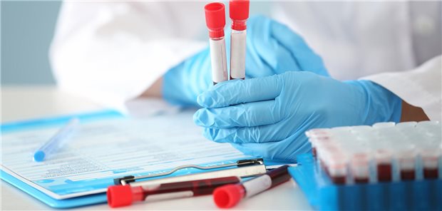 5 Blutproben in Röhrchen