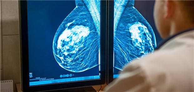Wer Brustkrebs besser diagnostiziert In der Studie wurden Mammografien von mehr als 28.000 Frauen aufgenommen, die gemeinsam von der KI und sechs Radiologen bewertet wurden.