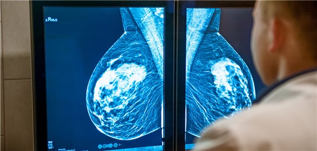 In der US-Studie ging ein hoher Verzehr von Milch mit einem um 50 Prozent erhöhten Brustkrebsrisiko einher. Eine klare Kausalität wurde aber nicht belegt.