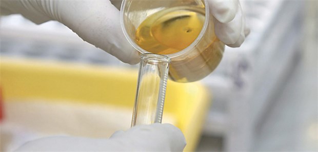 Uneins bei der Behandlung von Harnwegsinfekten In der Urinanalyse war ein positiver Leukozyten- oder Nitrittest für nahezu alle Ärzte ein Hinweis auf einen Infekt.