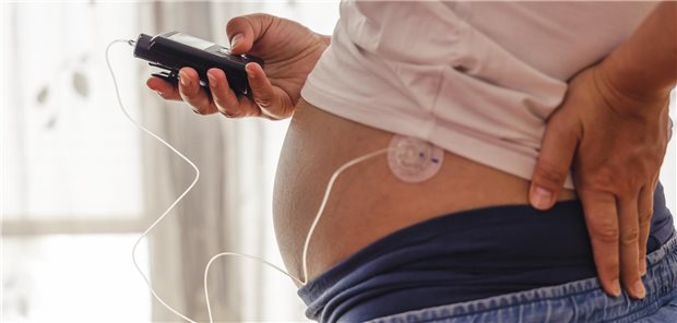 Eine schwangere Frau bedient eine Insulinpumpe mit der ihr Insulin über eine am Bauch angebrachte Drainage verabreicht wird.