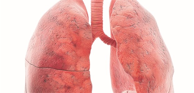 In der neuen COPD-Leitlinie werden für die ABCD-Einteilung, auf der die medikamentöse Therapie basiert, jetzt nur noch die Symptome und das Exazerbationsrisiko berücksichtigt © Springer Medizin Verlag