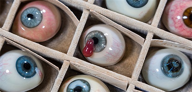 Glasaugen-Sammlung ist medizinhistorische Rarität In einem Setzkasten liegt ein Teil der insgesamt 132 Pathologien des historischen Glasaugenarchivs der Augenklinik des Rostocker Universitätsklinikums.