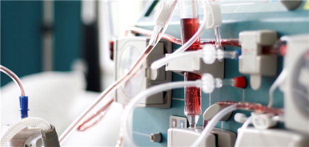 In einer Studie aus Wuhan starben 14 Prozent der dialysepflichtigen COVID-19-Patienten, bei den nierengesunden COVID-19-Patienten waren es dagegen nur 2 Prozent.