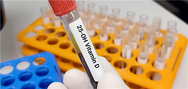 Vitamin-D-Mangel wohl kein Risikofaktor für SARS-CoV-2-Infektion COVID-19-Patientin in der Klinik: Bisher gibt es kaum Therapiemöglichkeiten.