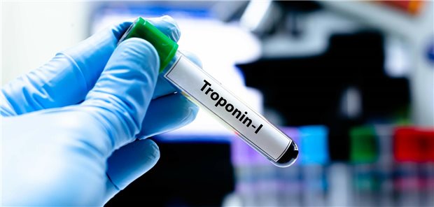 Testgefäß mit der Aufschrift &quot;Troponin-I&quot;.