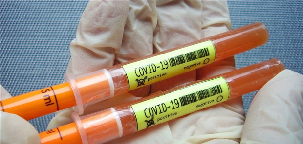 Forscher identifizieren Medikament zum Schutz vor SARS-CoV-2 In fast allen Bundesländern sind Infektionen mit SARS-CoV-2 bestätigt. Göttinger Forscher haben jetzt ein Medikament identifiziert, dass das Eindringen des Virus in die Lungenzellen blockieren könnte.
