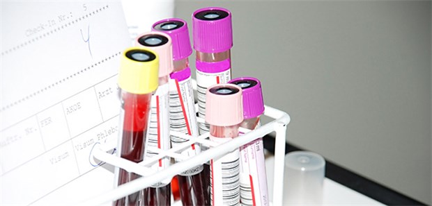 In-vitro-Diagnostika: Treiber für eine gesündere Welt oder doch nur ein Papiertiger? In ländlichen Gegenden mit rudimentären Gesundheitsinfrastrukturen fehlt es oft auch an Diagnostika.