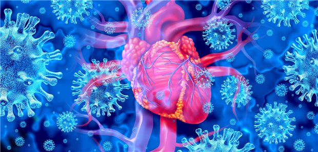 In sehr seltenen Fällen kommt es nach Impfung mit COVID-19-mRNA-Vakzinen zum Auftreten von Myokarditis oder Perikarditis. Zu diesen Krankheitsfällen werden kontinuierlich Daten erhoben.