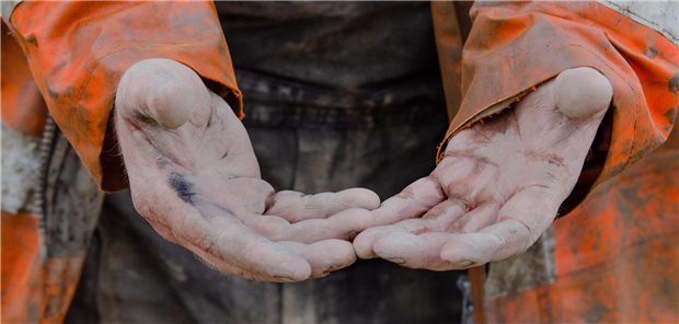 Ein Bauarbeiter zeigt seine schmutzigen, angegriffenen Hände.