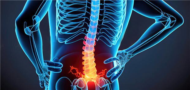 In vielen Fällen bleiben Rückenschmerzen über längere Zeit, offenbart eine deutsche Studie.