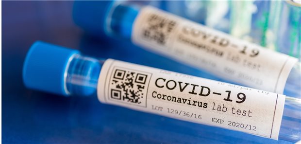 COVID-19-Tests bei Klinikpersonal nicht die Regel In vielen Krankenhäusern werden Mitarbeiter offenbar nicht konsequent auf SARS-CoV-2 getestet.