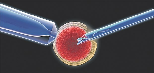 US-Mediziner preschen vor – trotz Unwägbarkeiten In-vitro-Fertilisation im Modell.