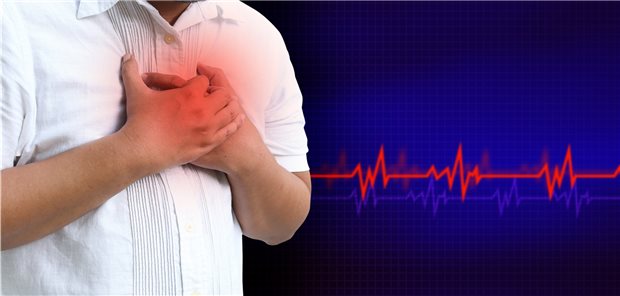 Infarktverdächtige Beschwerden (Thoraschmerzen oder Atemnot) und Ischämiezeichen im EKG: Auch wenn sich der Verdacht nicht bestätigt, haben die Betroffenen längerfristig offenbar eine schlechtere Prognose als Infarkt-Patienten.