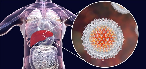 Infektion mit dem Hepatitis C-Virus: Durch DAA wird eine anhaltende virologische Antwort erzielt, die mit einer Reduktion von Leberschäden und Entzündungsvorgängen einhergeht.