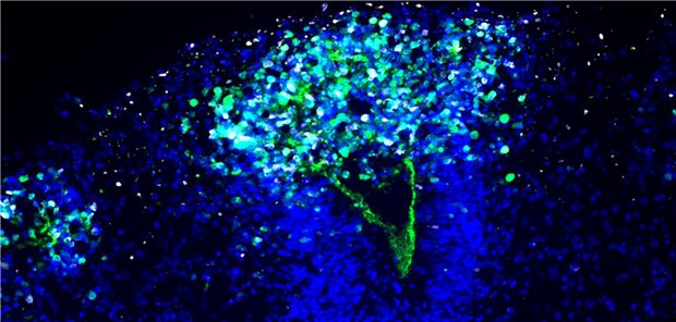 Infiziertes Organoid: Das Herpes-simplex-Virus (weiß) breitet sich im Organoid aus und zerstört so das Neuroepithel (grün) eines Ventrikels.