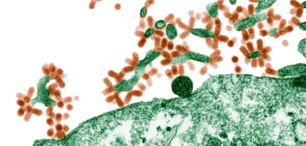 Wie gut ist die Welt gegen die Tricks der Viren gerüstet? Influenza-Viren (braun) werden von ihren Wirtszellen (grün) freigesetzt.