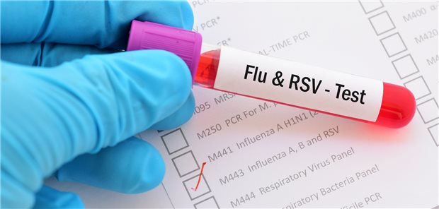 Virologe Keppler: Grippewelle flacht ab Influenzavirus und RSV haben in den letzten Wochen das Infektionsgeschehen dominiert.