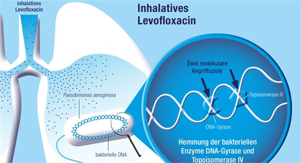 Inhaliertes Levofloxacin wirkt direkt auf Pseudomonas aeruginosa in der Lunge. Das Antibiotikum wirkt bakteriostatisch und bakterizid, indem es die bakteriellen Enzyme DNA-Gyrase und TopoisomeraseIV hemmt.