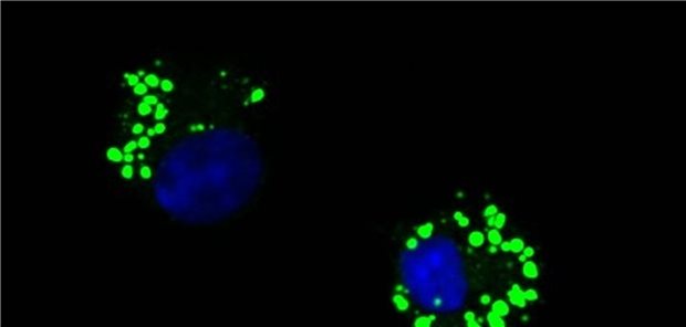 Hilft eine Diät gegen allergisches Asthma? Innate Lymphoid Cells (blaue Zellkerne) nehmen Fetttröpfchen (grün) zur Membrangenese auf.