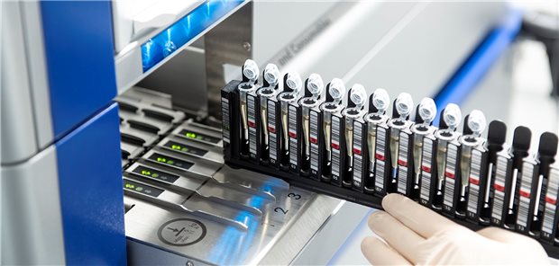 Neuer Versorgungsvertrag der TK: Liquid Biopsy spürt Keime auf Innerhalb kurzer Zeit werden die Blutproben auf über 1500 Erreger untersucht.