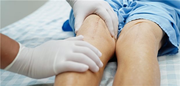Ein Arzt untersucht im Krankenhaus eine ältere Patientin, die eine Narbe von einer Kniegelenkersatzoperation am Knie aufweist.