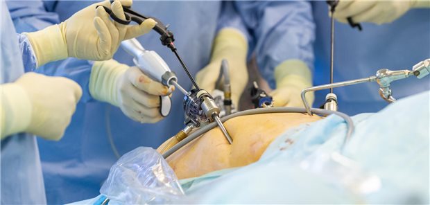 Die Hände eines Chirurgen bei der Handhabung von Instrumenten für die laparoskopische Chirurgie.