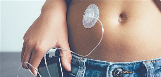 Insulinpumpe: Zuckerkranke Kinder lernen häufig schnell, damit unbefangen umzugehen.