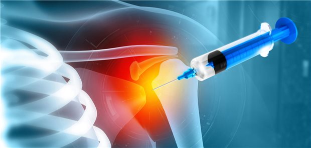 Schematische Darstellung einer Kortisonspritze
