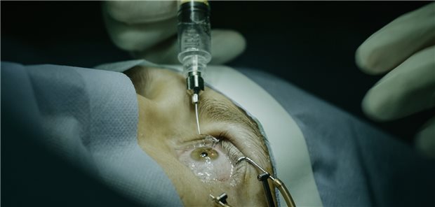 Intravitreale Injektion bei Makuladegeneration: Eine präventive Strategie mit Aflibercept bei diabetischer Retinopathie ergab jetzt in einer Studie keinen eindeutigen Nutzen.