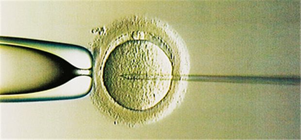 Intrazytoplasmatische Spermieninjektion (ICSI): Mit der Haltepipette wird die Eizelle angesaugt. Die Injektionspipette injiziert ein Spermium in die Eizelle. © epd