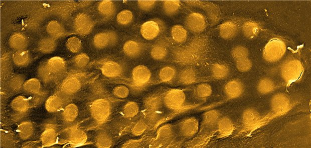 Invasion von Staphylokokken in eine Wirtszelle