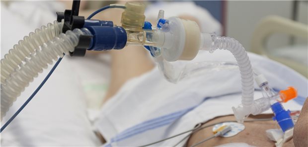 Invasive Beatmung: 20 bis 50 Prozent der außerklinisch invasiv beatmeten Patienten hatten zuvor keine strukturierte Entwöhnungsbehandlung erfahren.