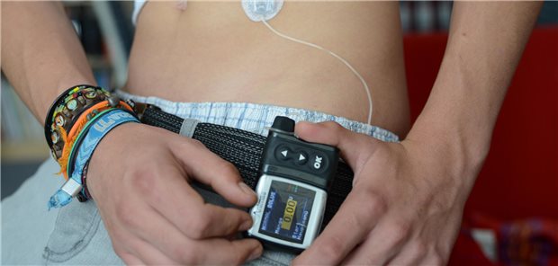 Junge mit Insulinpumpe