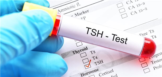Isoliert erhöhte TSH-Werte in der Altersgruppe der Senioren verweisen nicht immer auf eine subklinische Hypothyreose.