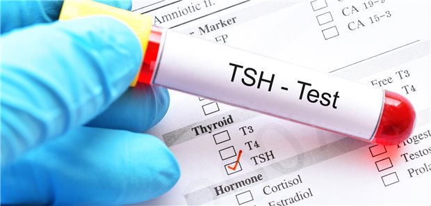 Ist der TSH-Wert erhöht? Eine subklinische Hypothyreose ist bei Patienten mit metabolisch assoziierter Fettlebererkrankung mit einer höheren Mortalität assoziiert.