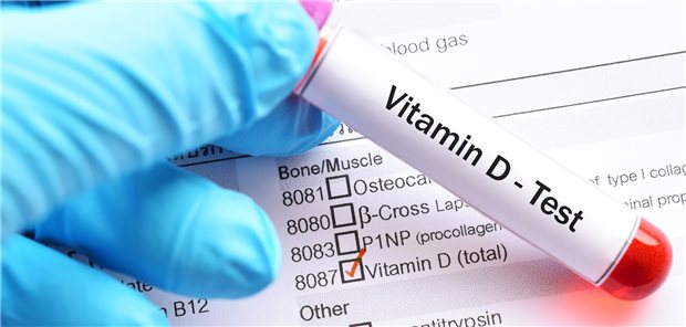 Ist der Vitamin-D-Spiegel zu niedrig? Patienten und Patientinnen mit Psoriasis bringt eine Vitamin-D-Supplementation im Winter offenbar nicht viel, was die Hautkrankheit betrifft.