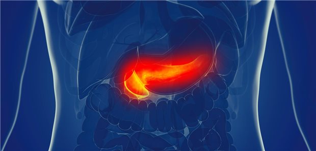Ist die Bauchspeicheldrüse entzündet, sollte zunächst die Schwere der Erkrankung bestimmt werden. Häufig verwendete Scores eignen sich nur bedingt, weshalb weitere Parameter eine Rolle spielen.