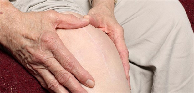 Ist gegen Arthrose-bedingte Gelenkschmerzen doch ein Kraut gewachsen?