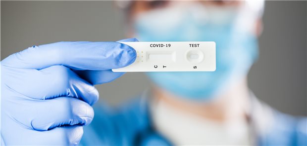 Nur noch zwei Corona-Tests pro Woche – KBV begrüßt Gesetzesänderung Je beschäftigter Person dürfen im Monat bis zu zehn Antigentests, die auf der BfArM-Liste stehen, über die KV abgerechnet werden. Erstattet werden 3,50 Euro pro Test.