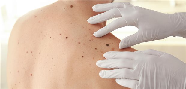 Dermatologe bei der Untersuchung eines Patienten in der Klinik.