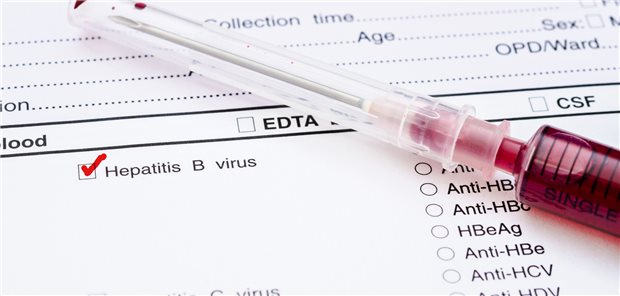 Je nach Rheumatherapie kann das Reaktivierungsrisiko für eine Hepatitis B bis zu 10 Prozent betragen.