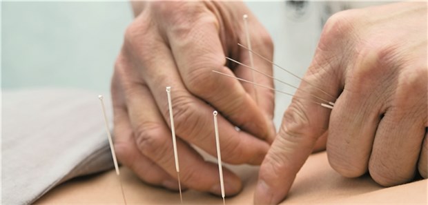 Jeder vierte Patient, der Akupunkturleistungen nachfragte, tat dies wegen Knie- oder Rückenschmerzen.