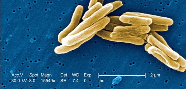 Resistente Keime bedrohen Fortschritte aus Jahrzehnten Jeder vierte Todesfall durch Antibiotika-resistente Keime weltweit wird durch Tuberkulose (TB) bedingt.