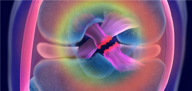 Jonathan Napolitano und sein Team resümieren, dass Präventionsprogramme gegen Kreuzbandverletzungen bei Profi-Sportlerinnen wirksam sind und sich mit minimalem Kostenaufwand implementieren lassen. 